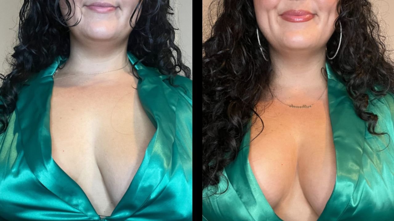 Side by side picture of a woman with and without breast tape