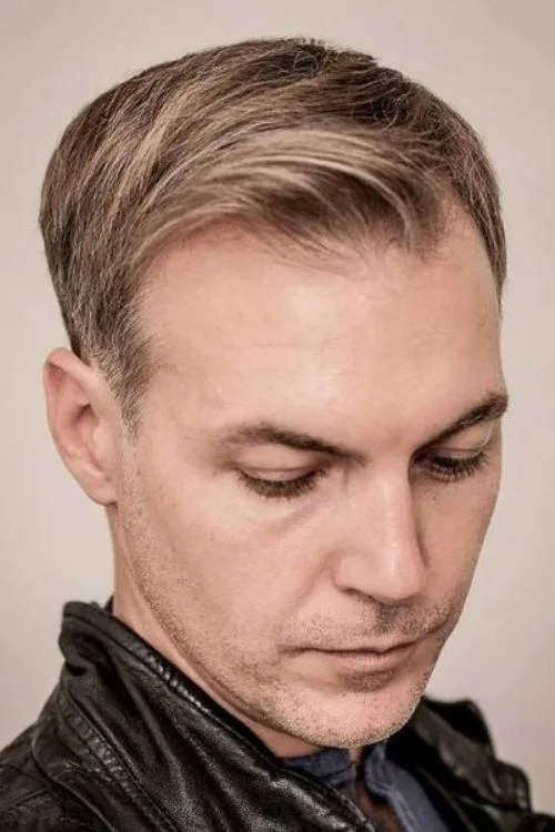 Ivy League for Receding Hairline