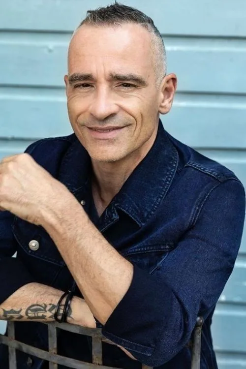 What Is a Receding Hairline